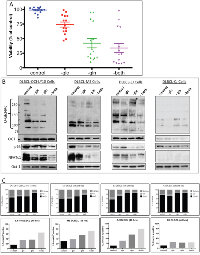 Increased uptake of glucose and glutamine by diffuse large B-cell lymphoma (DLBCL) cells correlates with N-acetylglucosamine (GlcNAc) protein modifications.