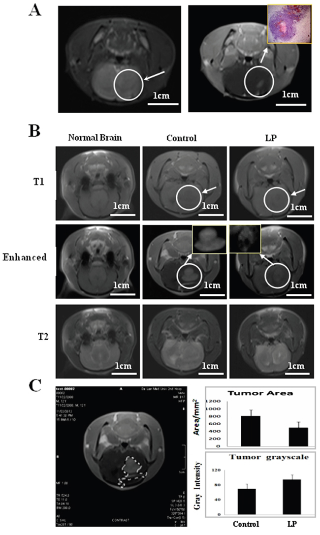 Monitoring tumor growth by magnetic resonance imaging (MRI).