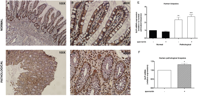 SLPI is expressed in human inflamed intestinal tract and further induced following quercetin exposure.