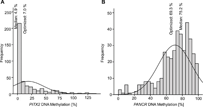 Histogram showing the distribution of PITX2 A. and PANCR B. values in tumor samples from HNSCC patients.