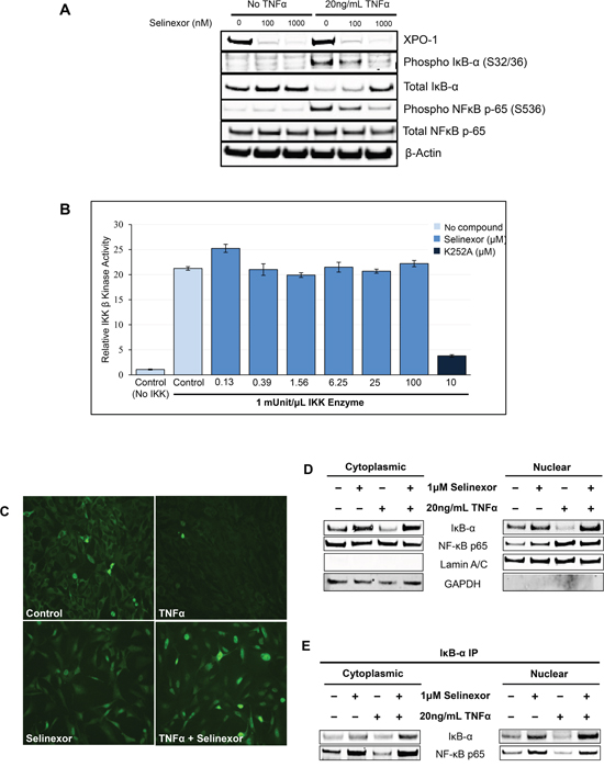 Inhibition of NF-&kappa;B transcriptional activity by selinexor is associated with nuclear localization of I&kappa;B-&alpha; and protection from degradation.