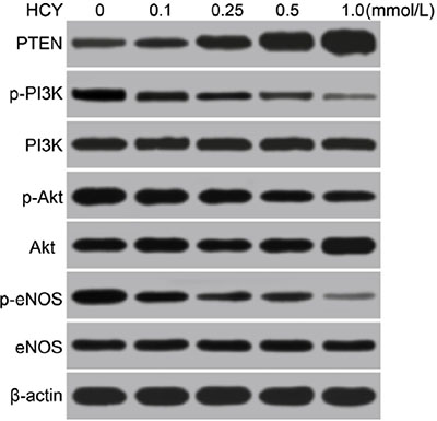 Effects of different doses (0, 0.1, 0.25, 0.5 and l.0 mmol/L) of HCY on the expressions of PTEN and the PI3K/Akt/eNOS signaling pathway-related proteins in HCAECs detected by Western blotting.
