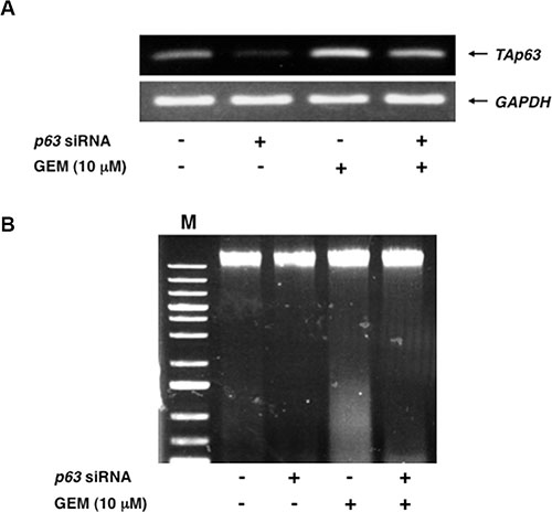 Silencing of p63 attenuates GEM-mediated DNA fragmentation.