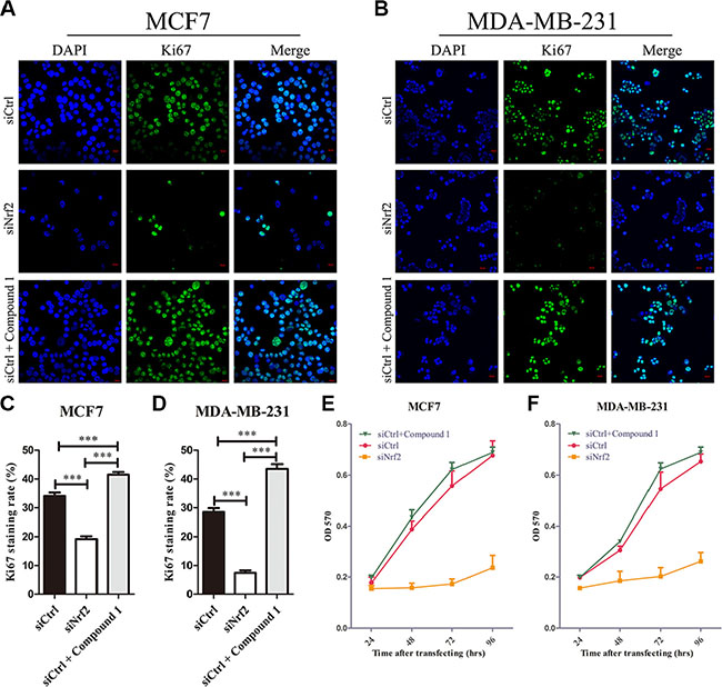 Knockdown of NRF2 inhibits cell proliferation of breast cancer cells.