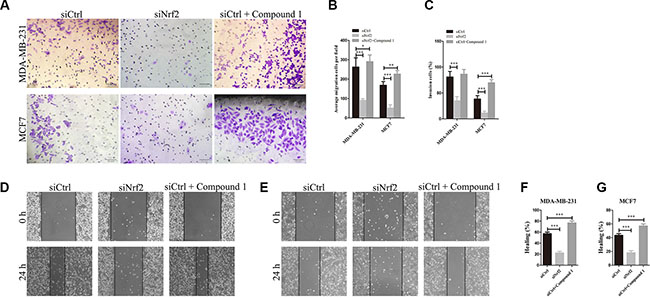 Knockdown of NRF2 inhibits cell metastasis of breast cancer cells.