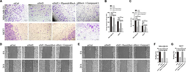 RhoA reverses the effect of NRF2 downregulation on cell metastasis.