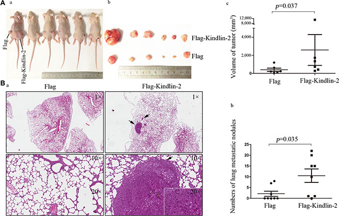 Kindlin-2 promotes glioma cell growth and metastasis in vivo.