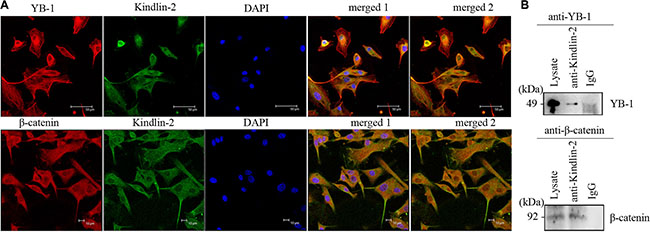 Kindlin-2 forms a complex with YB-1 and &#x03B2;-catenin.