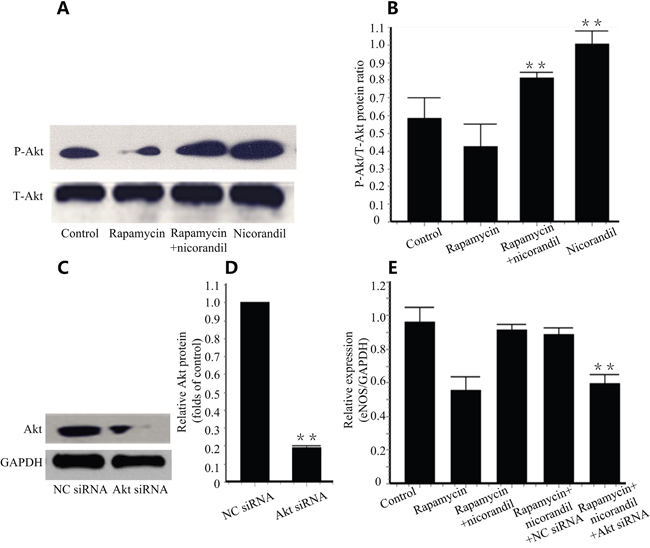 Nicorandil promotes Akt/eNOS in CMECs.