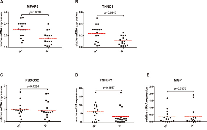 Quantitative comparison of MFAP5 (A), TNNC1 (B), FBXO32 (C), FGFBP1 (D) and MGP (E) mRNA expressions in 16 paired TSCC with or without occult CLNM.