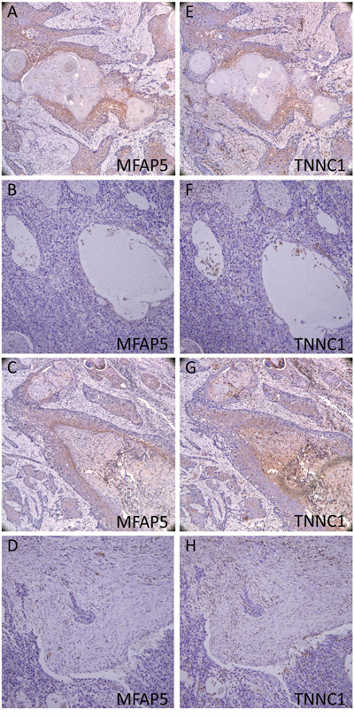 Immunohistochemistry of MFAP5 and TNNC1.