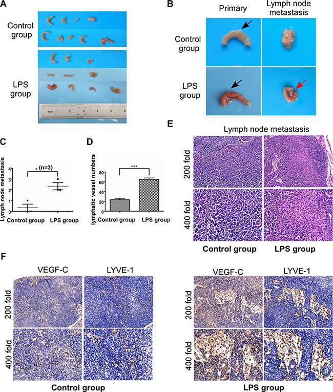 LPS promotes lymphangiogenesis and lymph node metastasis via VEGF-C in vivo.