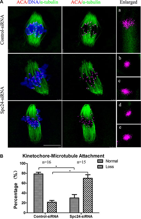 Correct kinetochore-microtubule attachment depends on Spc24.