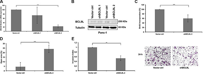 RNAi-mediated knockdown of BCL9L diminishes proliferation, migration and invasion of pancreatic cancer cells.