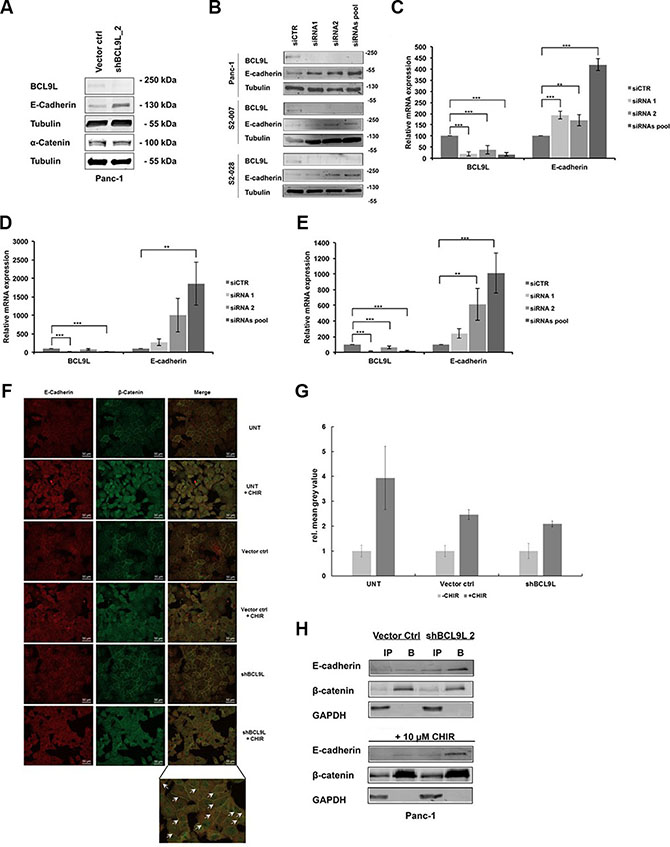 Knockdown of BCL9L stimulates E-cadherin expression and plasma-membrane retention in complex with &#x03B2;-catenin.