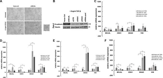RNAi-mediated inhibition of BCL9L expression counteracts epithelial-mesenchymal transition in pancreatic cancer cells treated with TGF-&#x03B2;.