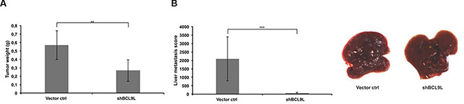 BCL9L knockdown inhibits growth and abrogates liver metastasis of pancreatic cancer cells