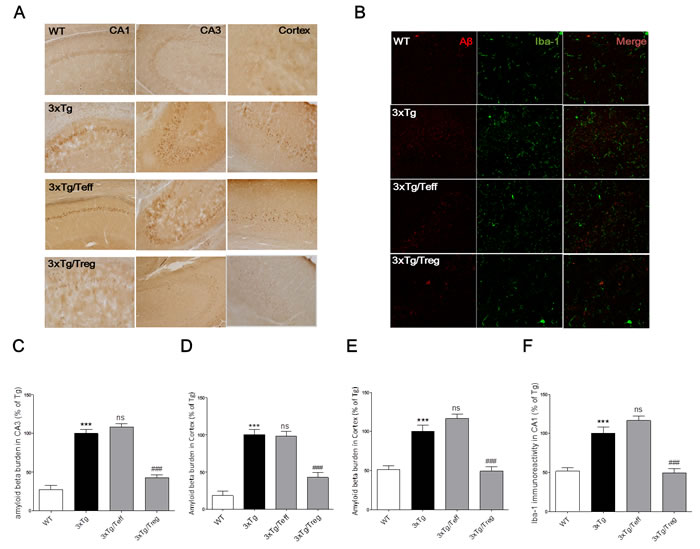 Effects of adoptive transfer on A&#x3b2; deposition and microglia activation in the brain of 3xTg-AD mice.