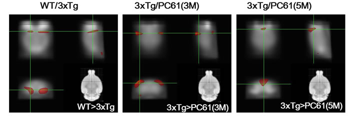 Depletion of Tregs decreases glucose uptake in the brain.