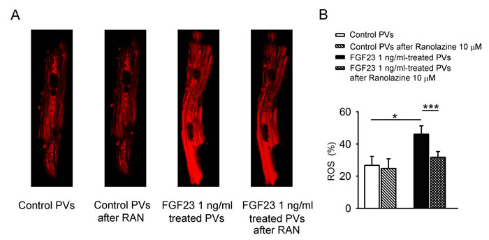 ROS in mitochondria of control and FGF23-treated PV cardiomyocytes.