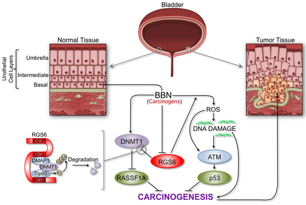 Schematic outlining the critical tumor suppressor role of RGS6 in bladder.