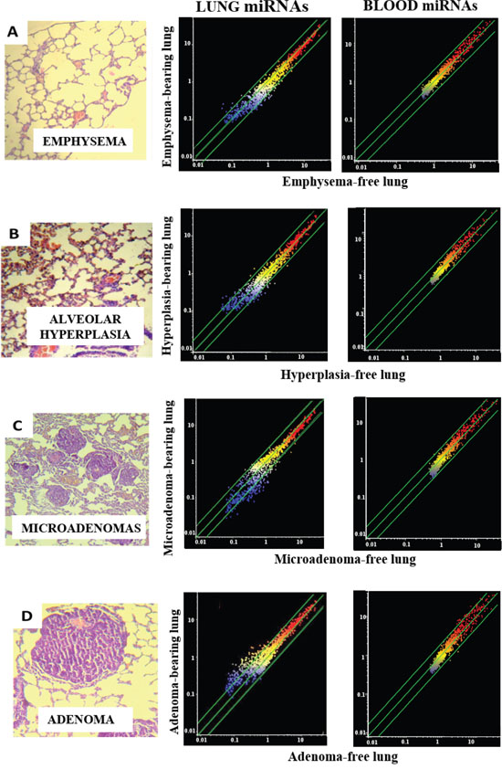 miRNA expression intensity in mouse lung and blood serum as related to pulmonary histopathological alterations.