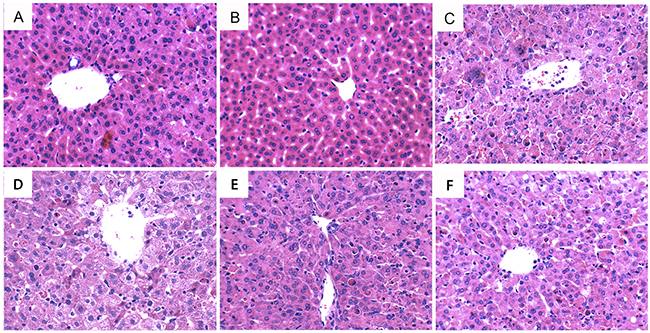 Effects of oxymatrine on As2O3-induced liver histopathologic changes.