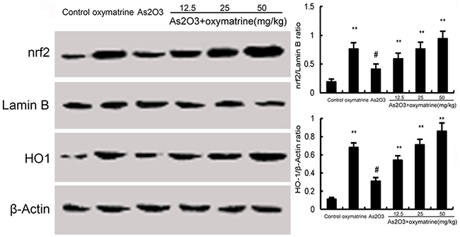 Effects of oxymatrine on Nrf2 and HO-1 expression.