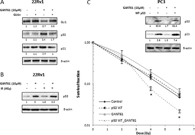 Role of p53 in radiosensitizing effect of GANT61.