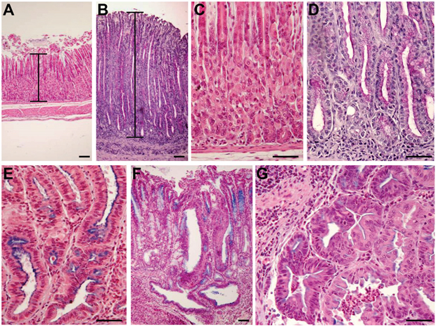 Development of histopathological lesions of the gastric mucosa after Helicobacter pylori infection in iqgap1+/- mice.