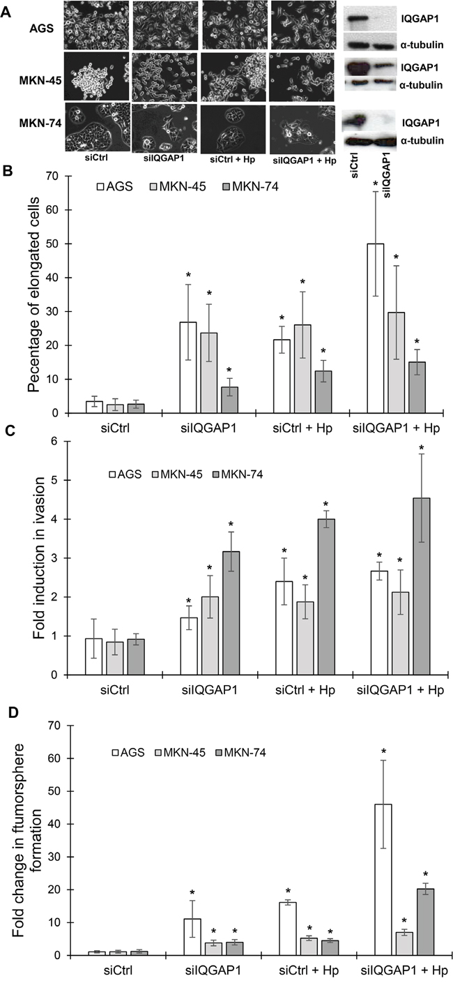 IQGAP1 inhibition mimicks Helicobacter pylori induced effects on gastric epithelial cell morphology, invasion capacities and tumorsphere formation.