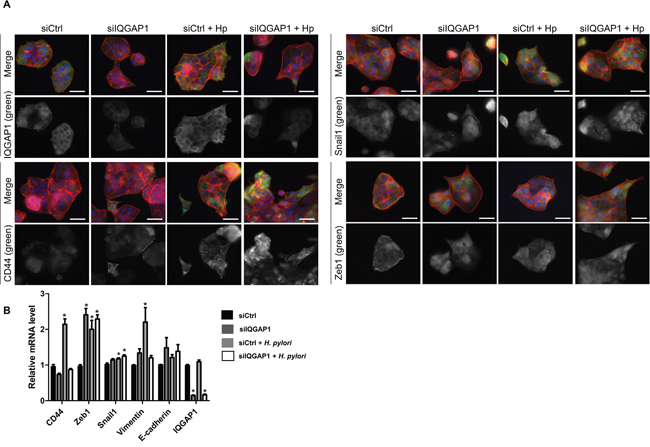 IQGAP1 inhibition accentuates Helicobacter pylori effect on EMT and CD44 expression in MKN-74 cells.