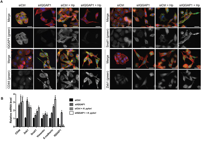 IQGAP1 inhibition accentuates Helicobacter pylori effect on EMT and CD44 expression in AGS cells.