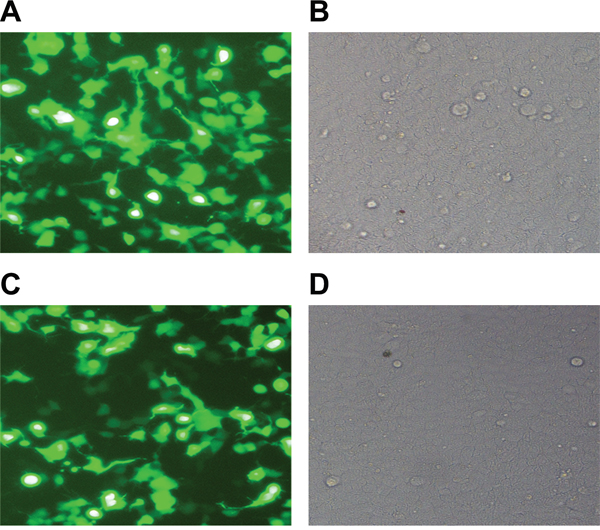 Observation of lentivirus packaging and infection efficiency.