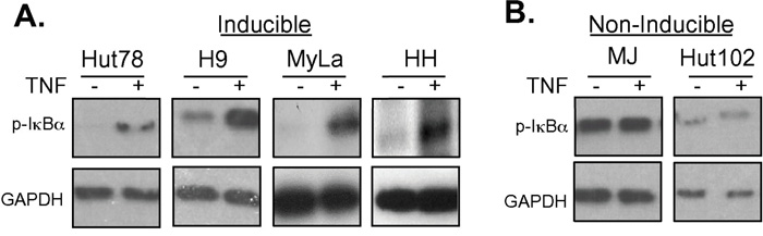 Doxycycline resistant cell lines are resistant to TNF-induced NF-&#x03BA;B pathway activation.