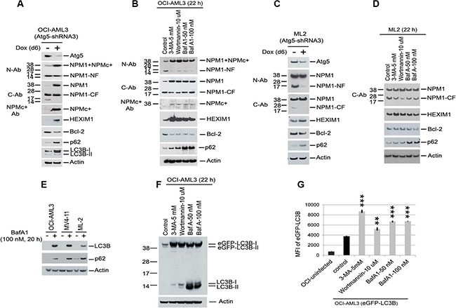 Reduction of proteolytic degradation of NPM1/NPMc+, HEXIM1, and LC3B with autophagy inhibition.