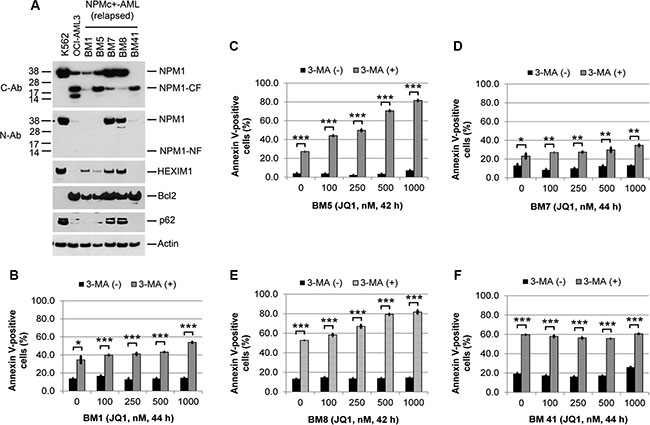 Effects of autophagy inhibition on JQ1-induced apoptosis in primary NPMc+ AML cells.