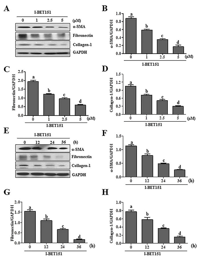 Figure1: I-BET151 inhibits serum-induced activation of renal interstitial fibroblasts in a dose and time dependent manner.