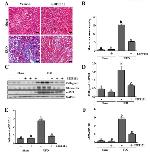 Administration of I-BET151 alleviates development of deposition of ECM in obstructed kidneys.