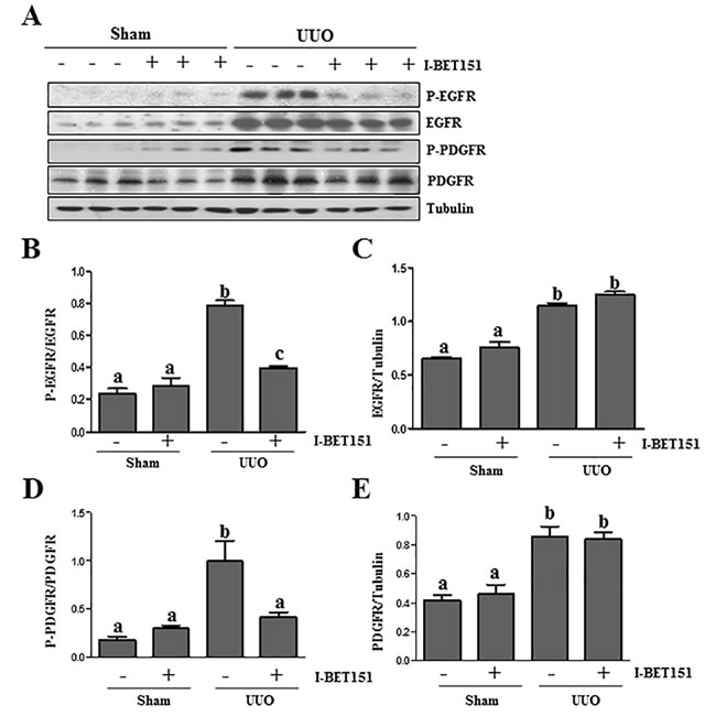 I-BET151 inhibits phosphorylation of EGFR and PDGFR&#x3b2; in obstructed kidneys.