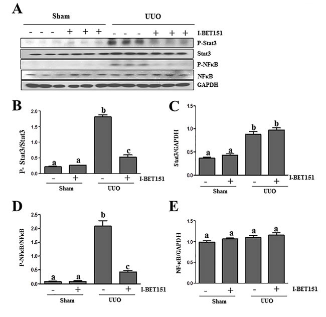 I-BET151 inhibits phosphorylation of STAT3 and NF-&#x3ba;B in the kidney after obstructed injury.