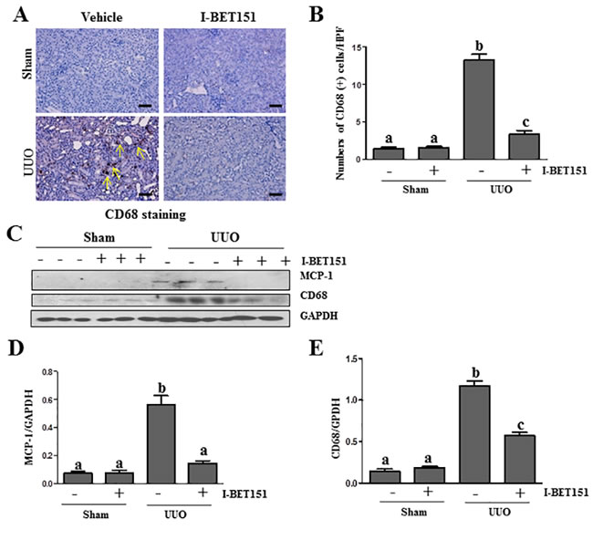 I-BET151 suppresses expression of MCP-1 and infiltration of macrophage in the obstructed kidneys.