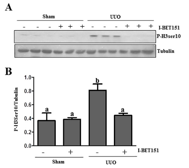 I-BET151 decreases the expression of phospho-histone H3 at Ser10 in the kidney after UUO injury.