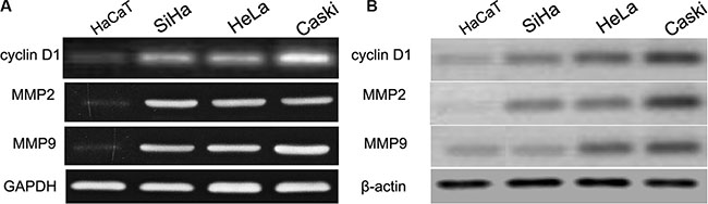 cyclin D1, MMP2 and MMP9 were up-regulated in CC cell lines and HaCaT cells.