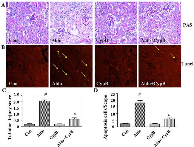 Effects of CYPB overexpression on tubular injury in aldosterone (Aldo)-induced mice.
