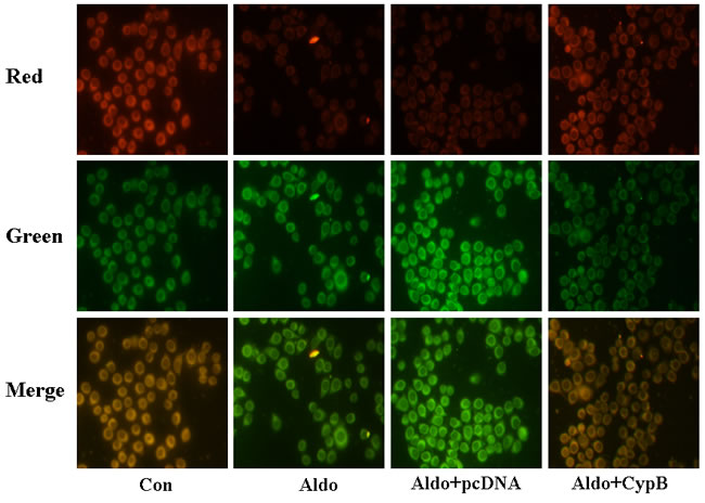 Aldosterone (Aldo) induces mitochondrial membrane potential (MMP) depolarization.