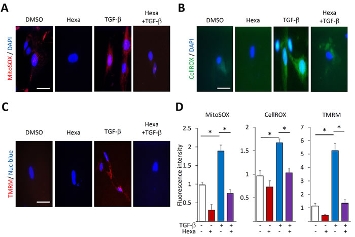 Hexafluoro abrogates TGF-&#x3b2;-induced ROS production and mitochondrial membrane potential.