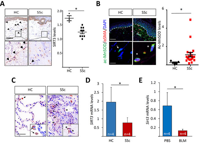 Attenuated SIRT3 expression and activity in SSc and in mouse models of fibrosis.