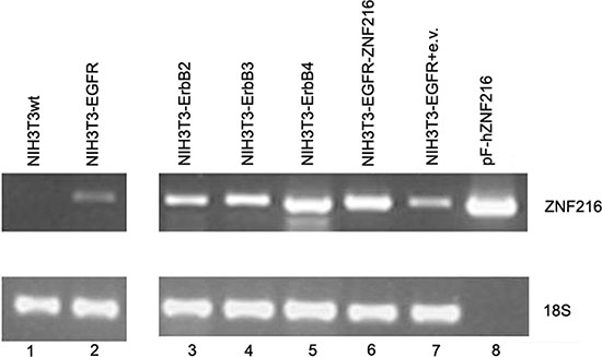 ZNF216 mRNA expression in NIH3T3 transfectant cell lines expressing individual ErbB receptors.