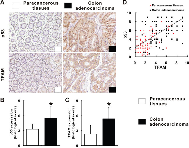 p53 and TFAM expression in colon adenocarcinoma tissues.